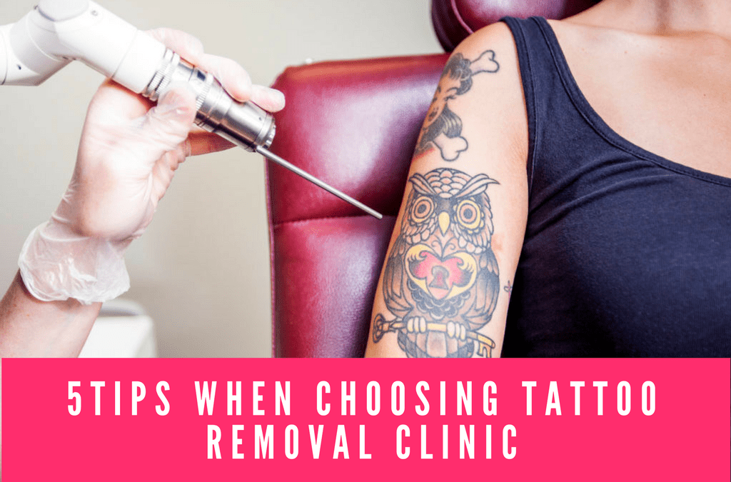 Top 5 Tips When Choosing a Tattoo Removal Clinic